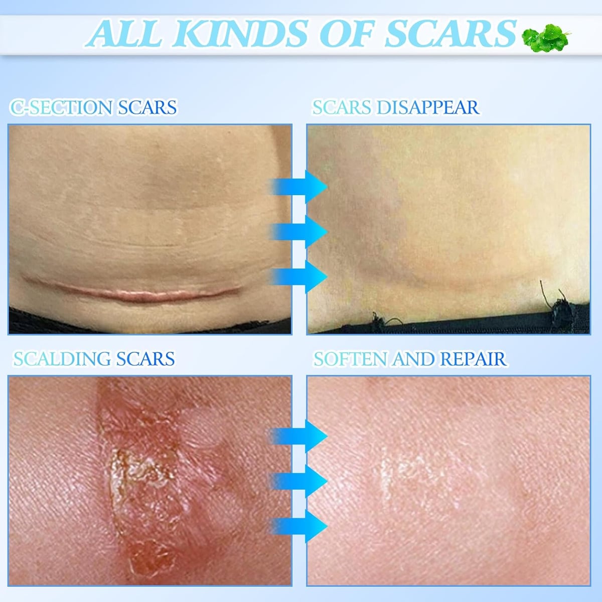 Crema Reparadora Cicatrices + Piel Lisa en Semanas