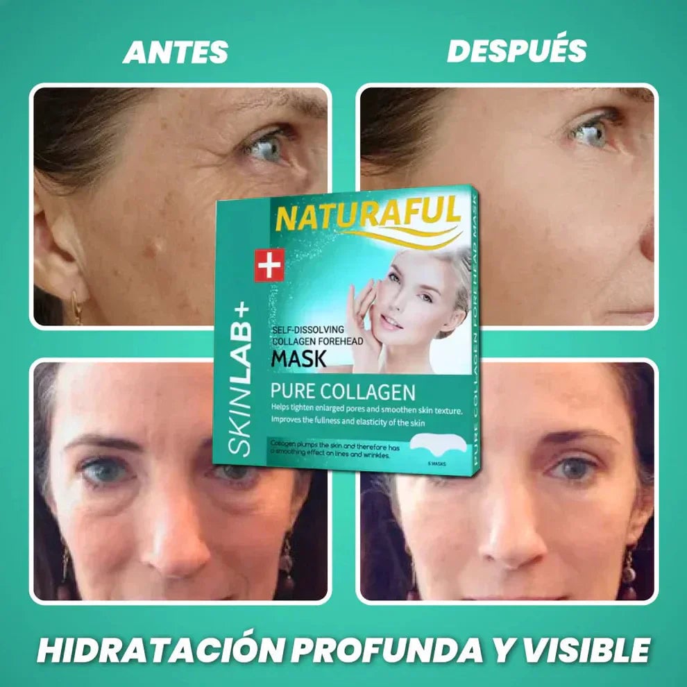 NaturalFul® Parches De Colágeno Absorbentes  ✨❤️ + ENVÍO GRATIS 🚚