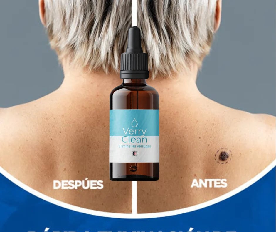 ULTIMAS UNIDADES - 2X1 Verryclean Eliminador de Verrugas + ENVÍO GRATIS