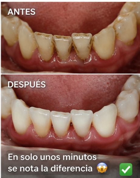 Foto de Elder Batz