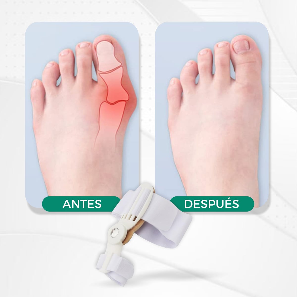 OrtoFlex© -Corrector de Juanetes