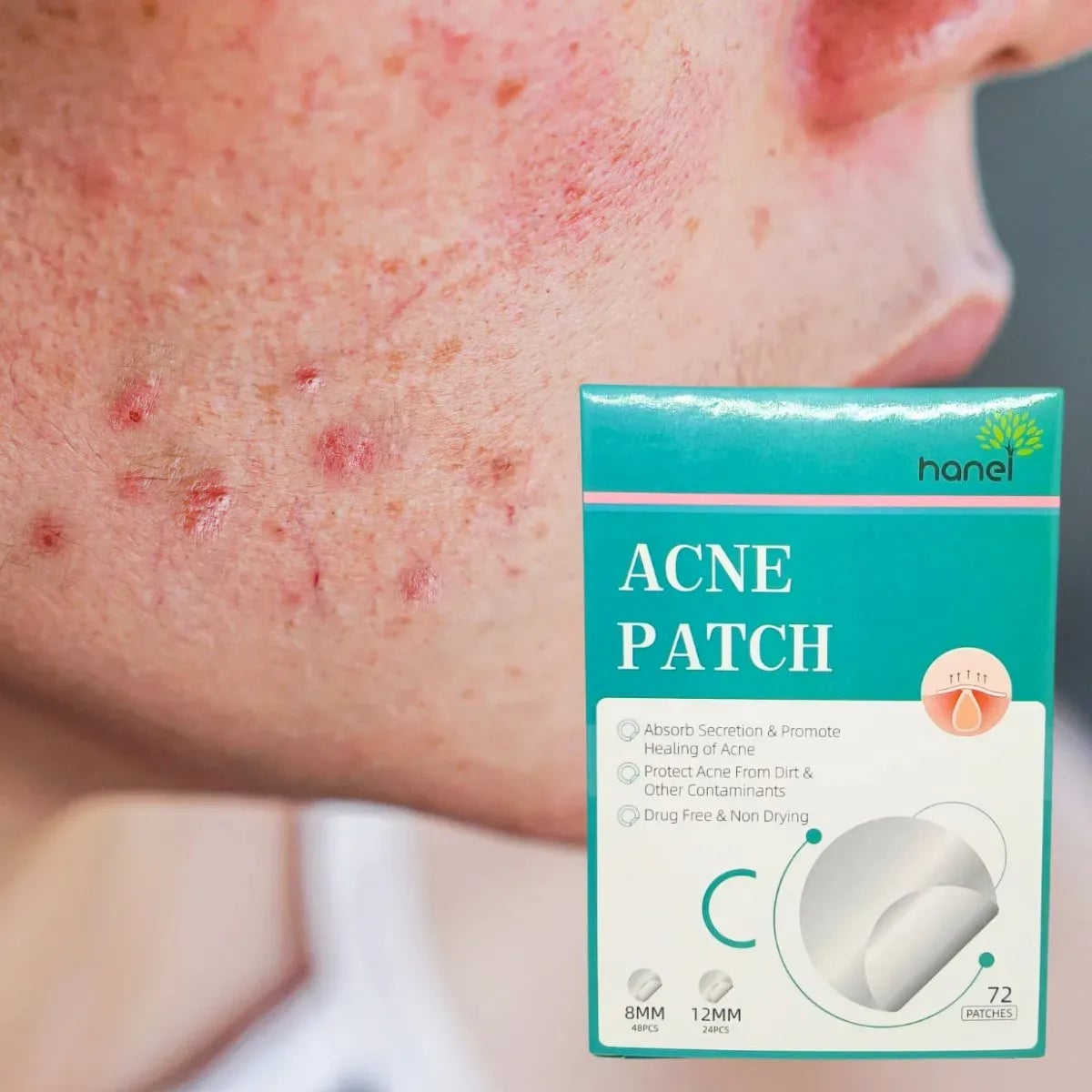 Parches Anti-Granitos Hidrocoloides + ENVIO GRATIS