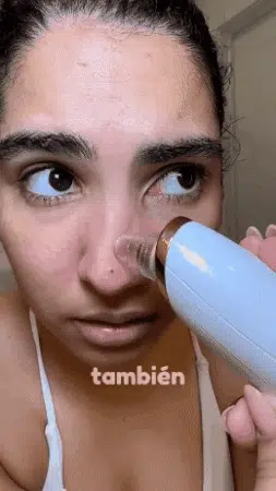 ✨ Succionador de Espinillas y Puntos Negros Profesional