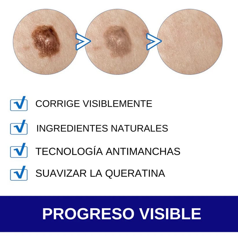 WART REMOVER - Elimina verrugas y lunares carnosos