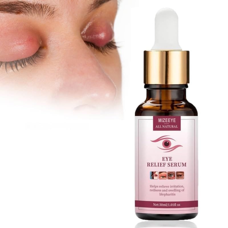 ULTIMAS UNIDADES - ELIMINA ESE DOLOR DEL OJO CON MIZEEYE + ENVÍO GRATIS 🎁