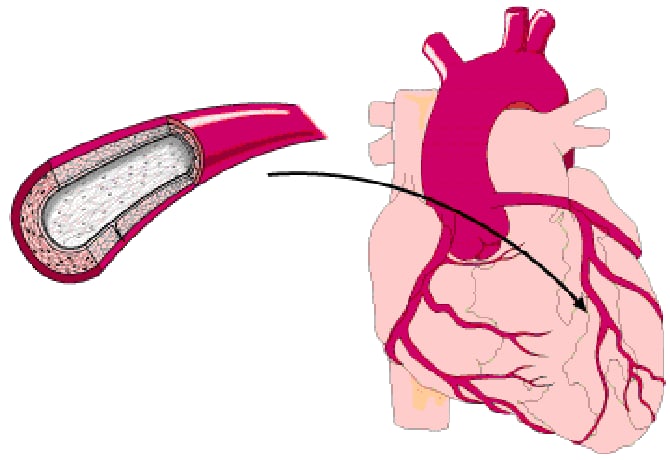 Tensiómetro de muñeca con voz - Controla la actividad cardiaca en segundos