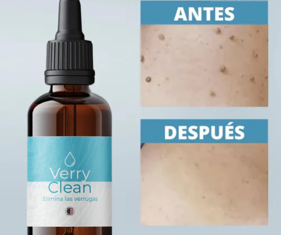 ULTIMAS UNIDADES - 2X1 Verryclean Eliminador de Verrugas + ENVÍO GRATIS