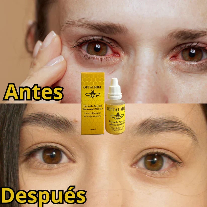 OFTALMIEL™🐝 Alivio y frescura para tus ojos + ENVÍO GRATIS 🎁