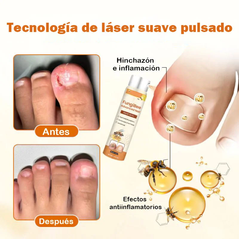 Spray Reparador de Uñas con Veneno de Abeja