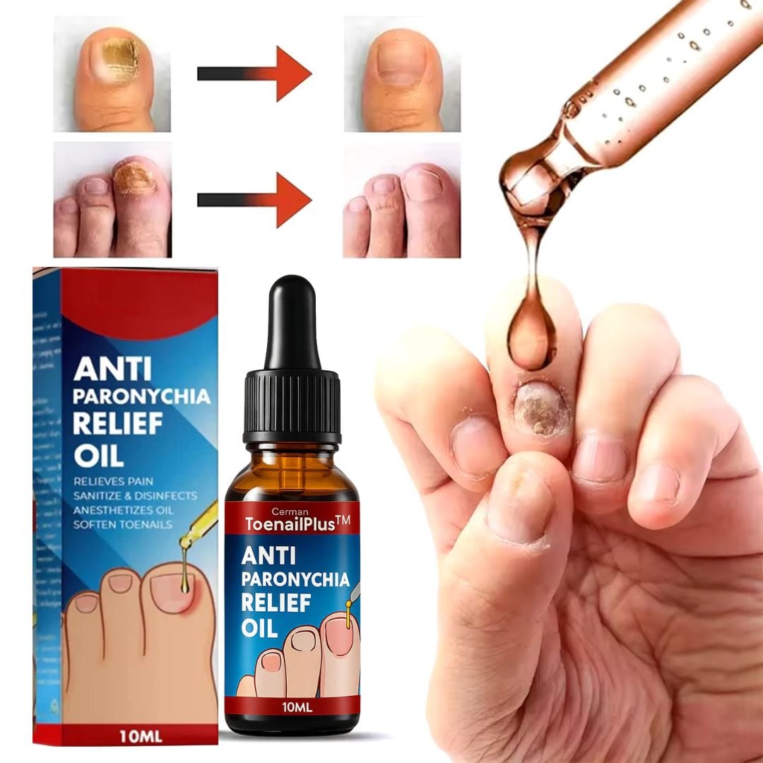 Aceite Eliminador de Hongos y Uñas Encarnadas EHOHE + ENVIO GRATIS