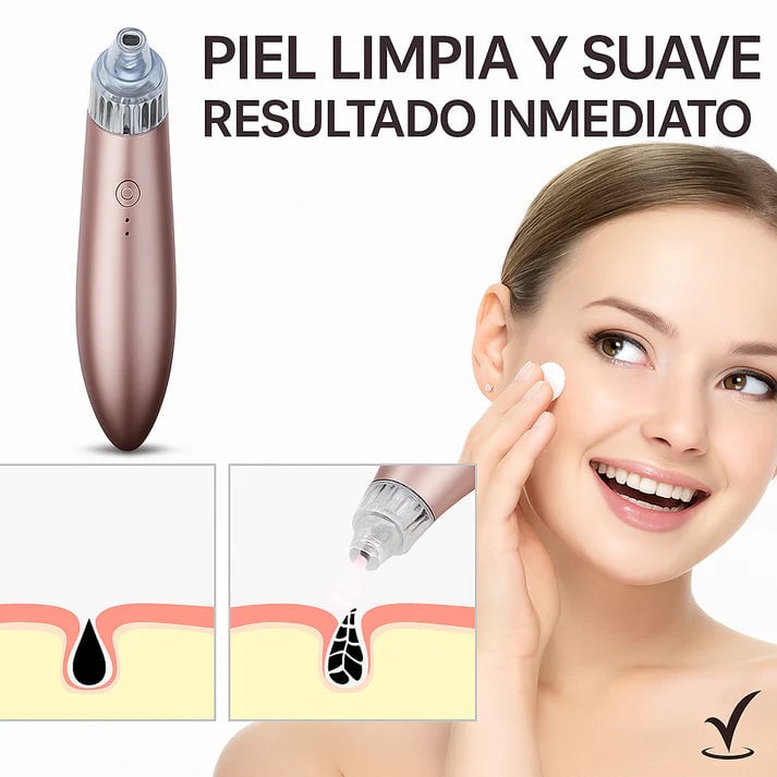 Extractor Profesional de Puntos Negros y Espinillas