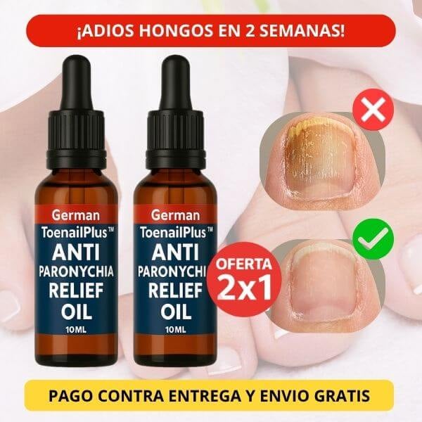 Aceite Eliminador de Hongos y Uñas Encarnadas EHOHE + ENVIO GRATIS