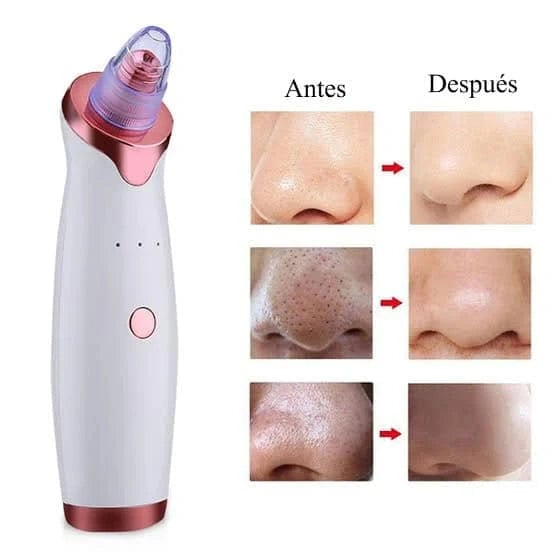 ✨ PoreClean® Pro — Adiós puntos negros y espinillas visibles en minutos