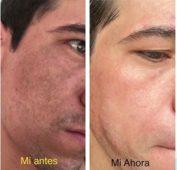 Foto de Carlos Martinez