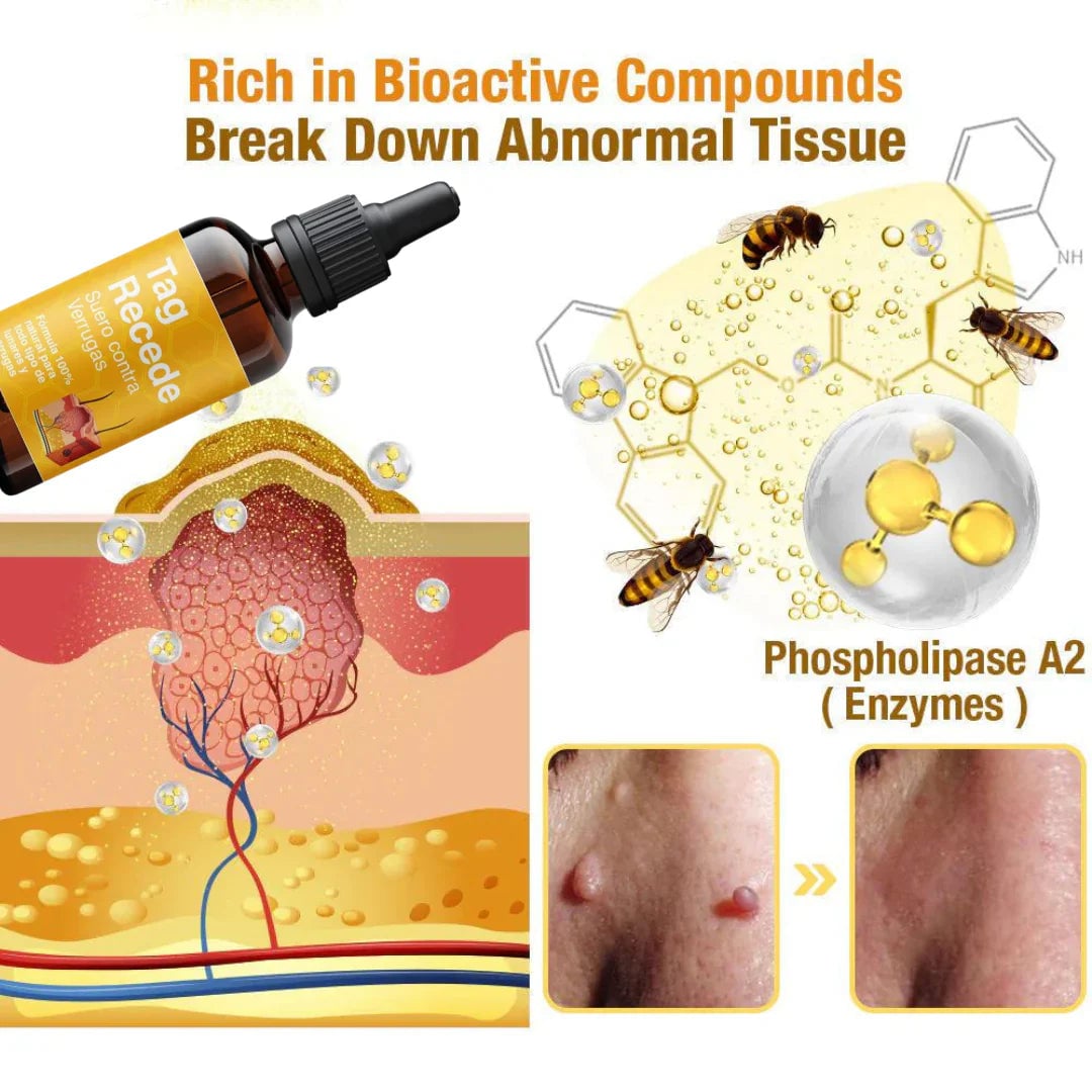 TRATAMIENTO PARA VERRUGAS Y LUNARES🐝👨‍⚕ + ENVIO GRATIS