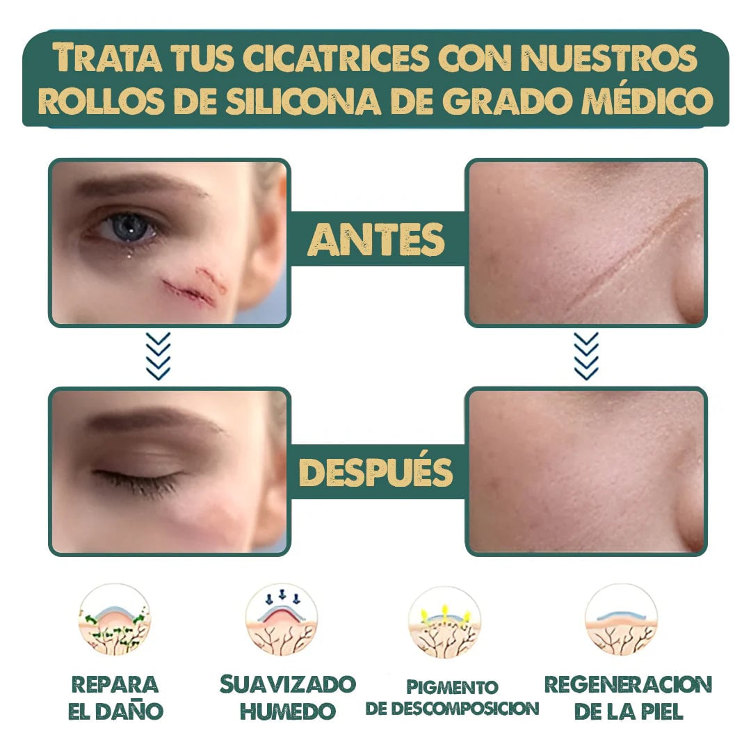 Cinta Cicatrizante , Dile adiós a las cicatrices en semanas!