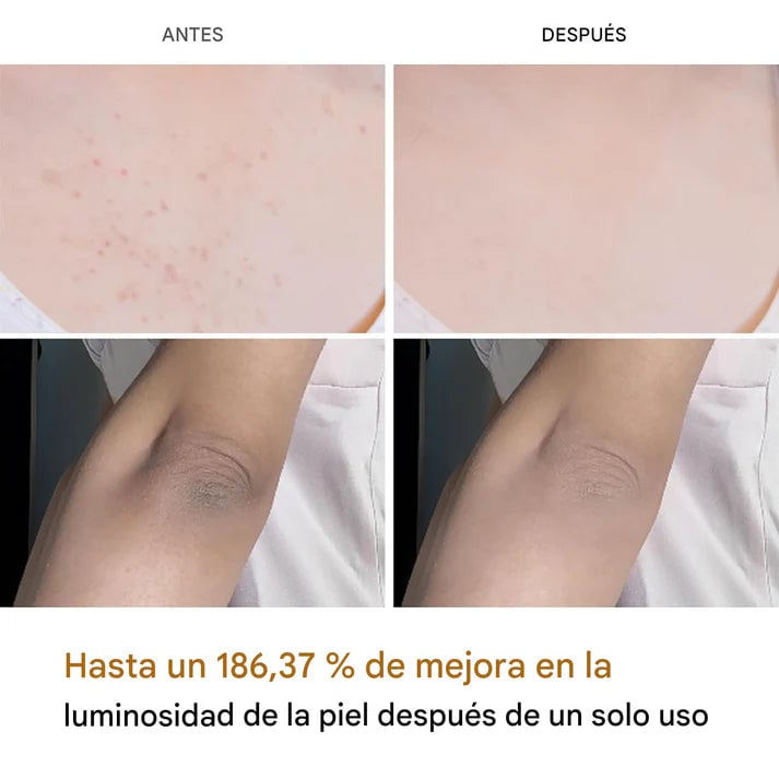 EXFOLIANTE MELAXIN PARA ACLARAR PARTES OSCURAS - FORMULA CURCUMA