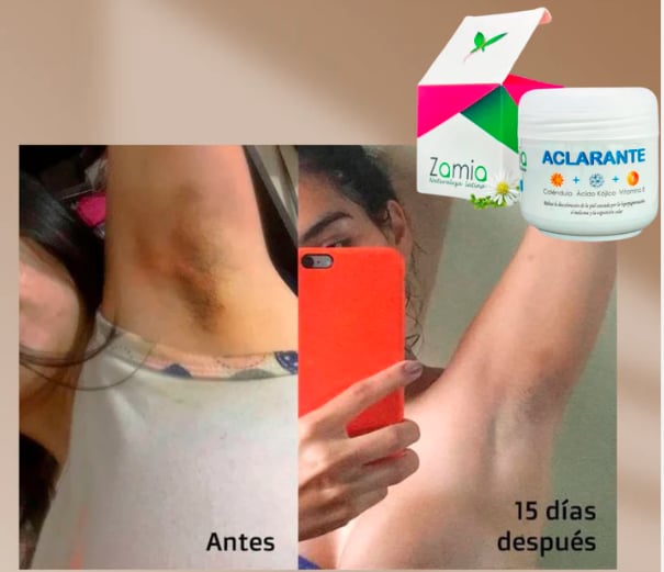 Crema Aclarante Zamia ✨ Despídete de las manchas + Envío Gratis