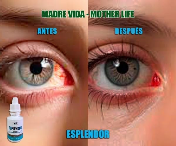 Alivio Visual Esplendor + Envío Gratis