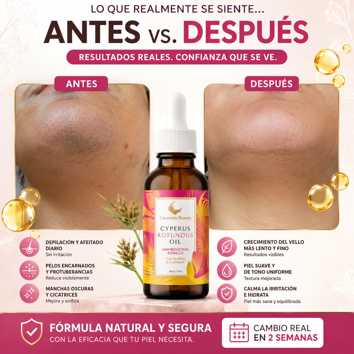 Aceite de Cyperus Rotundus para el Cuidado Corporal