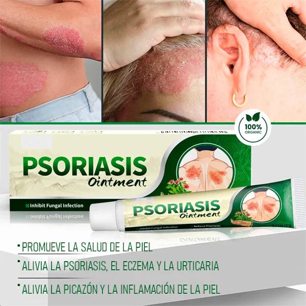 ✅ PSORIASIS™ | Alivia la picazón y el enrojecimiento de la piel desde la primera aplicación ☀️