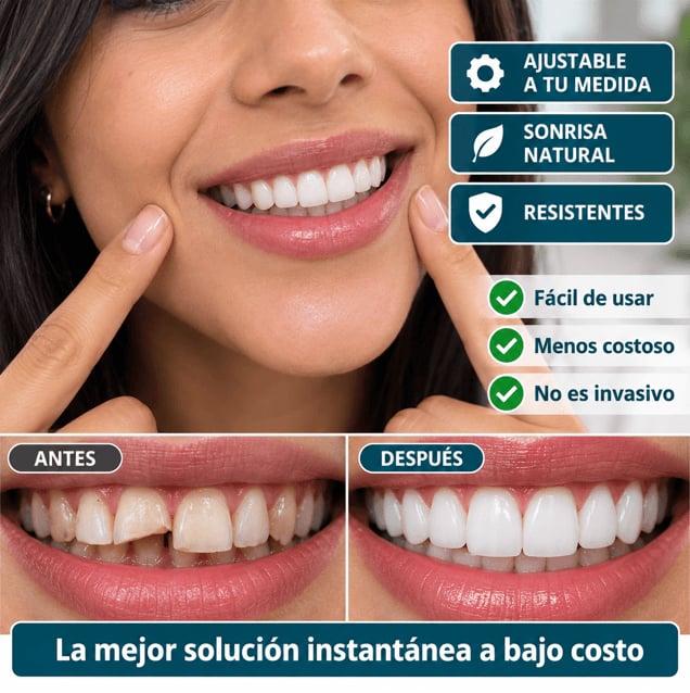 SNAPON SMILE™ CARILLAS DENTALES
