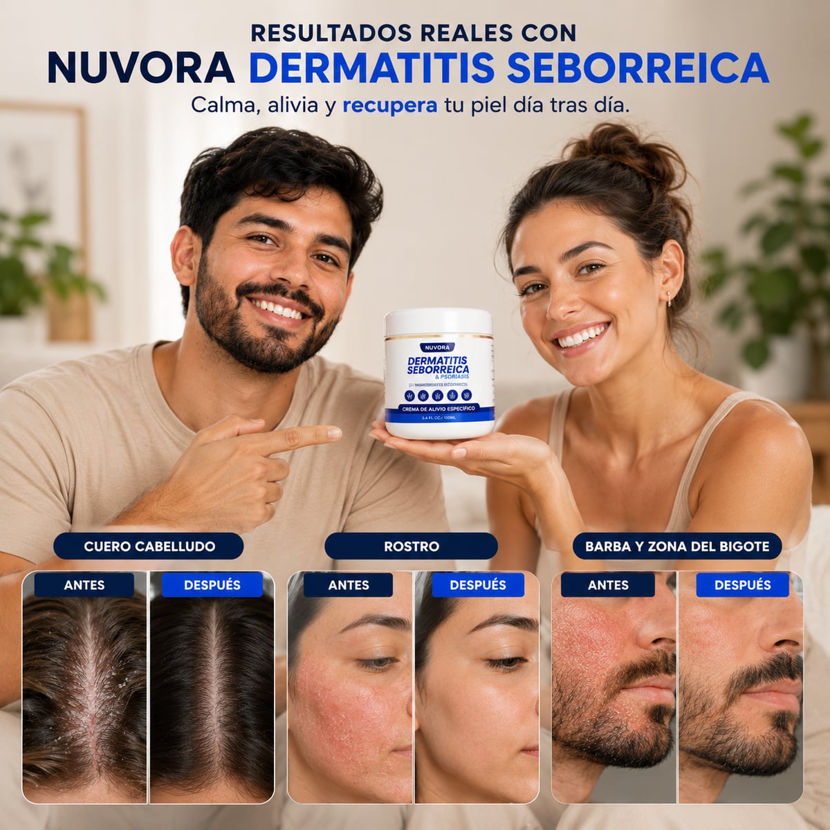 NUVORA Crema de Alivio para Dermatitis Seborreica y Psoriasis