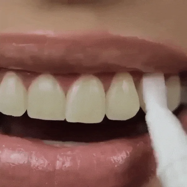 EFERO® (Lápiz blanqueador dental)