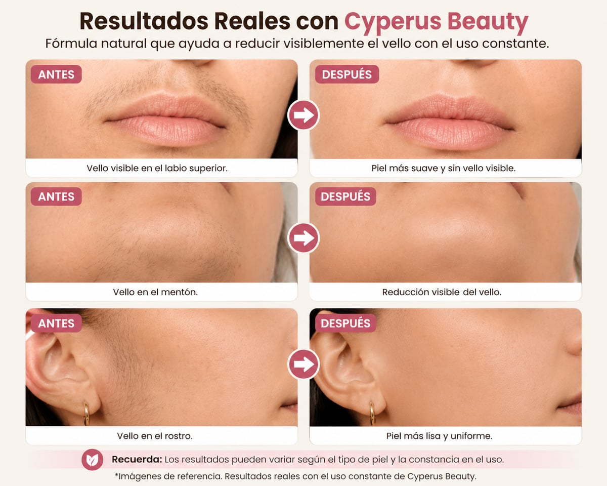 Aceite Cyperus Rotundus ✨ Disfruta una piel más suave por más tiempo