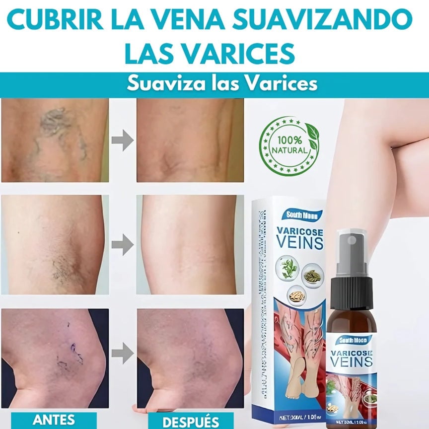 Spray Anti-Varices 100% Natural ¡Oferta 2X1!