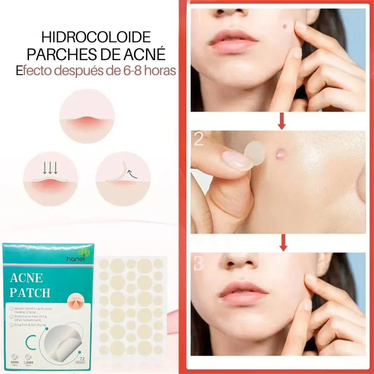 Parches Anti-Granitos Hidrocoloides + ENVIO GRATIS