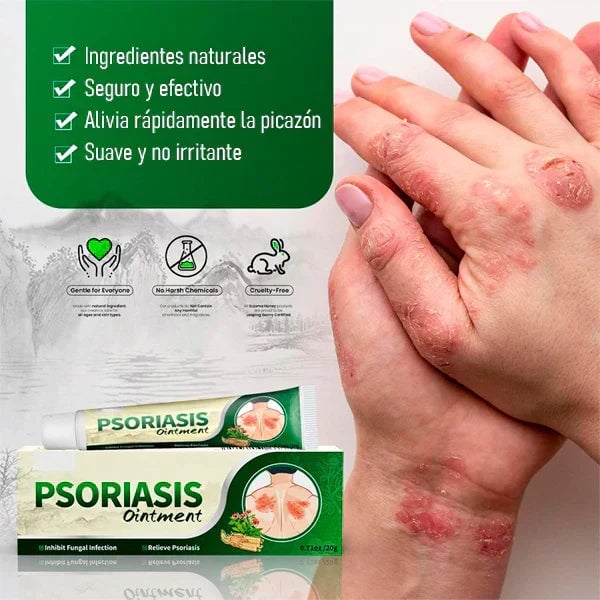 PSORIASIS™ Crema Antifúngica y Antipicazón | 20g ☀️
