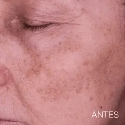 Jabón de Cúrcuma Natural -   ¡LIBERATE DE LAS MANCHAS Y EL ACNE! 🧼🍂 Paga 1 y Lleva 2😱