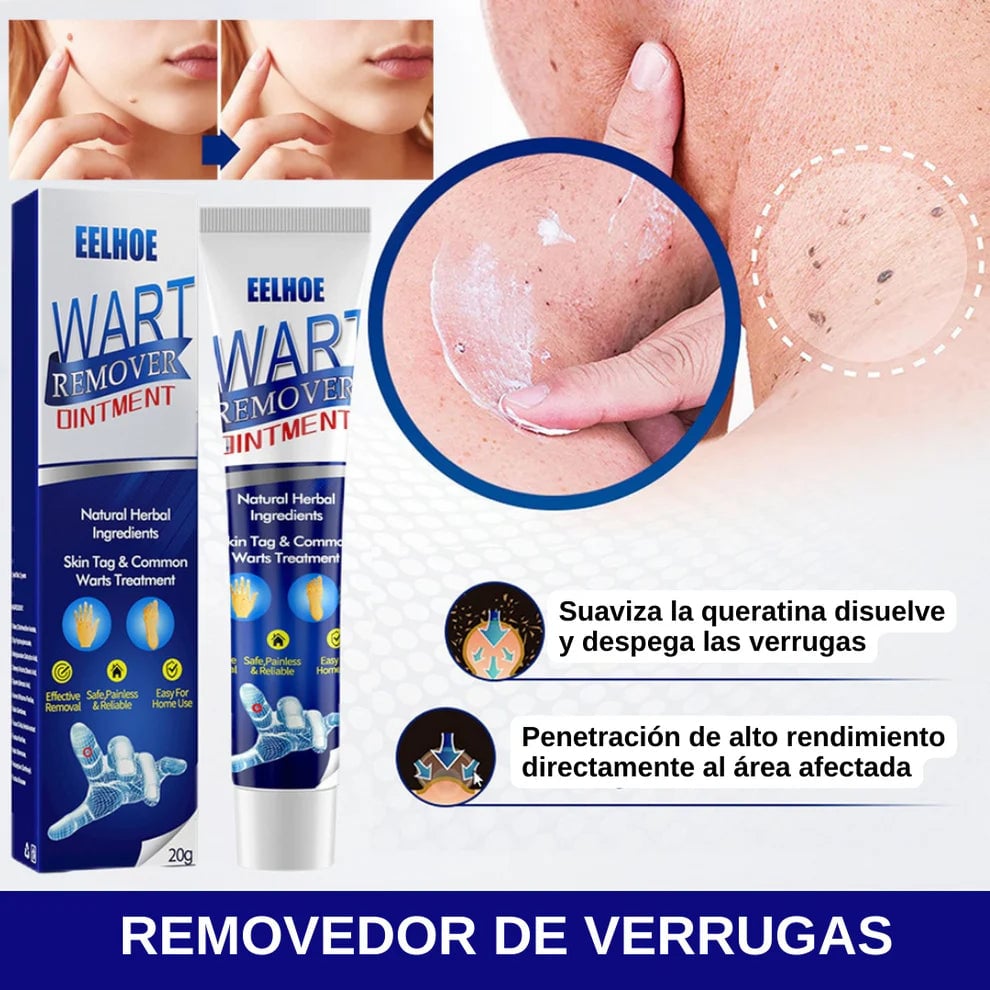WART REMOVER - Elimina verrugas y lunares carnosos