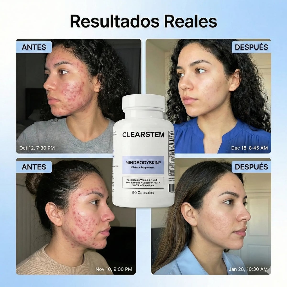 MINDBODYSKIN Clearstem - Acaba con el Acné Hormonal en 7 Días.