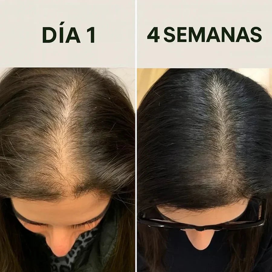 Shampo de Batana oil - Crecimiento y Reparación Capilar