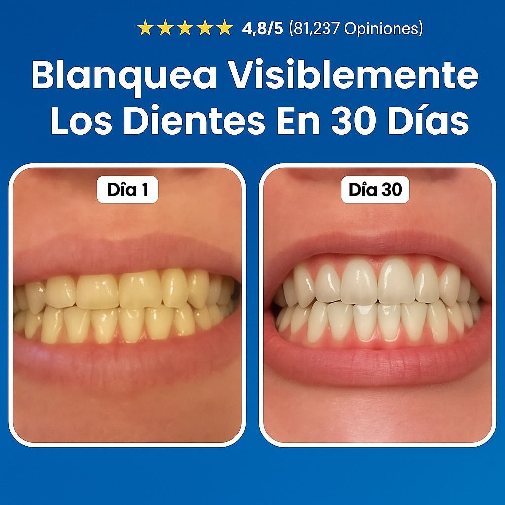 🦷Reparación Dental Elimina Caries, Placa y Sarro - 🛡️ Escudo Natural restaurador Para Esmalte Avanzado 🦷¡Dile adiós a las caries de forma natural y efectiva!🦷