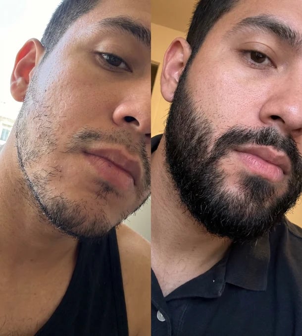 Bálsamo para Crecimiento y mantenimiento de Barba 