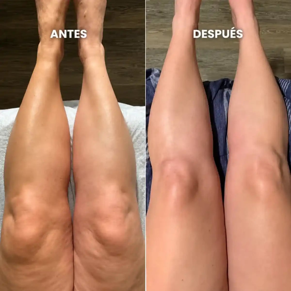 Transforma tu Cuerpo - Gotas de Drenaje Linfatico
