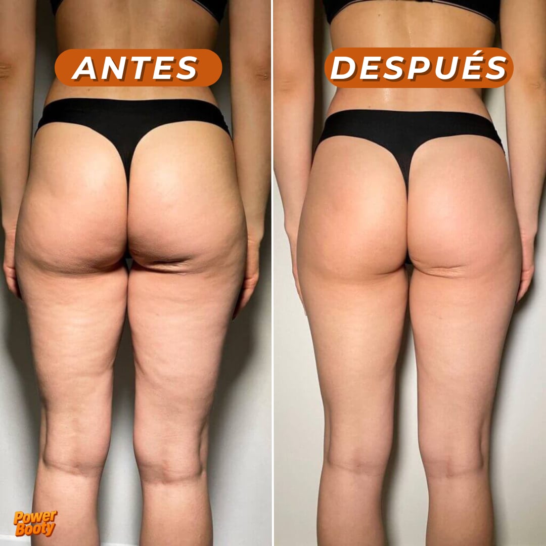 Masajeador y Tonificador Reafirmante para Glúteos