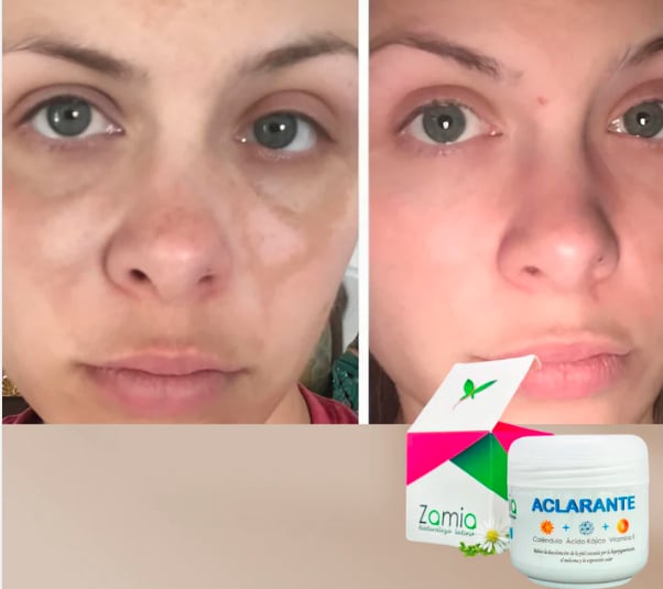 Crema Aclarante Zamia ✨ Despídete de las manchas + Envío Gratis
