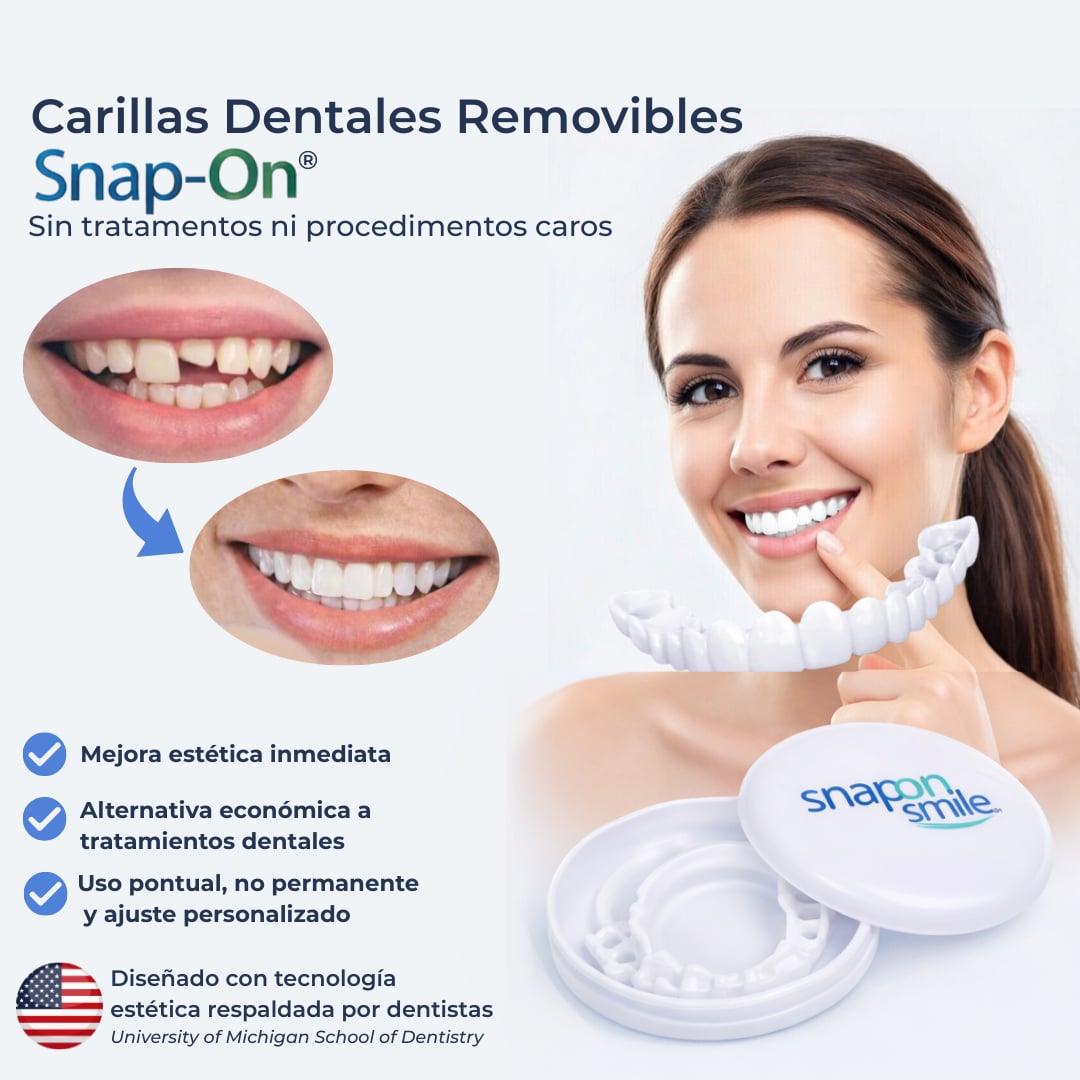 Snap Smile- Carillas dentales removibles