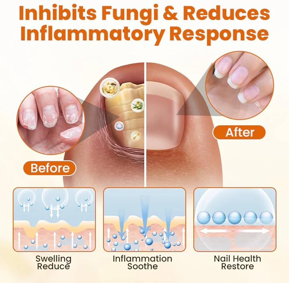 🐝FUNGI BEE - SPRAY - RESTAURADOR DE UÑAS ANTI-HONGOS CON VENENO DE ABEJA🐝
