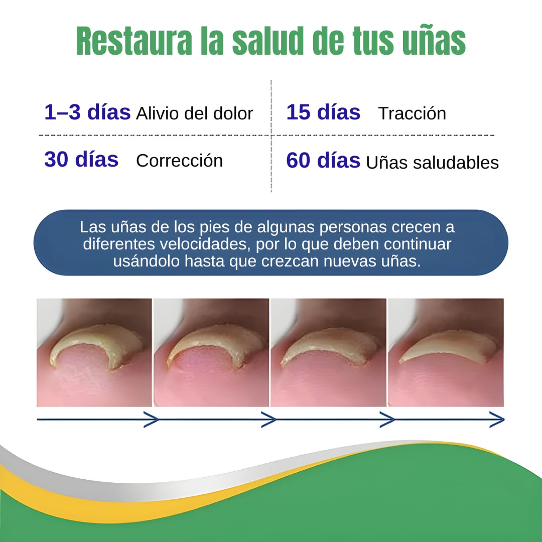 ULTIMAS UNIDADES - PARCHE REPARADOR UÑA – ELIMINA HONGOS, PROTEGE Y RECUPERA UÑAS ENCARNADAS + ENVIO GRATIS