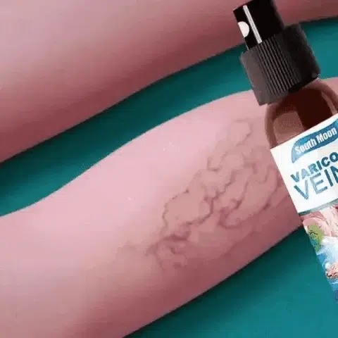 VenaPure™ – Dile adiós a las varices en 2 semanas 💧 | Resultados clínicamente probados + Envío GRATIS