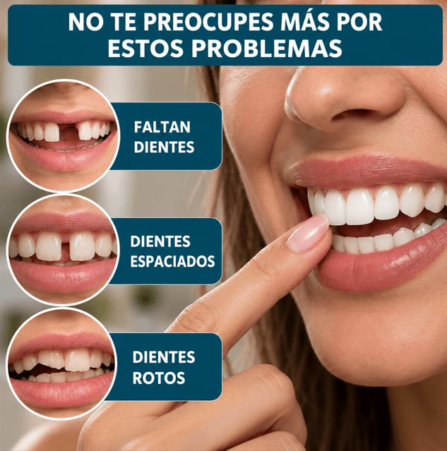 SNAPON SMILE™ CARILLAS DENTALES