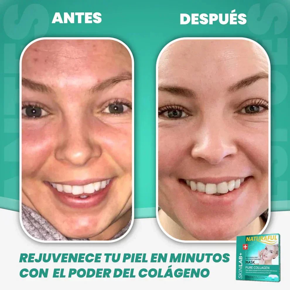 NaturalFul® Parches De Colágeno Absorbentes  ✨❤️ + ENVÍO GRATIS 🚚