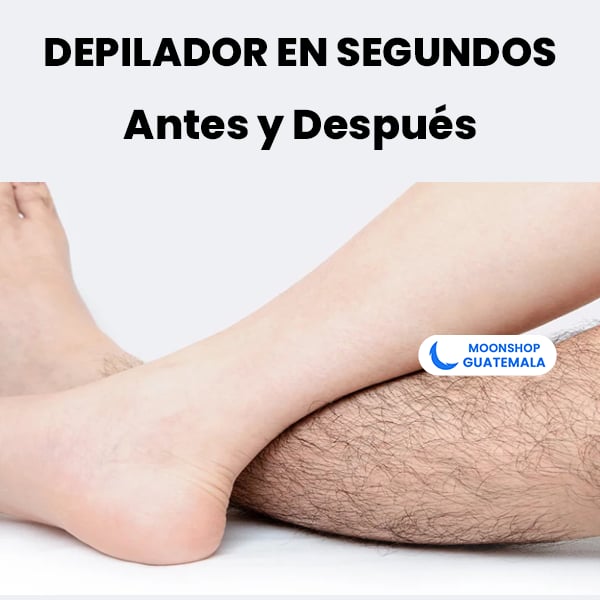 OFERTA 2x1 ⭐️ Spray Depilador para Hombres y Mujeres - 100% ORIGINAL Y SIN DOLOR