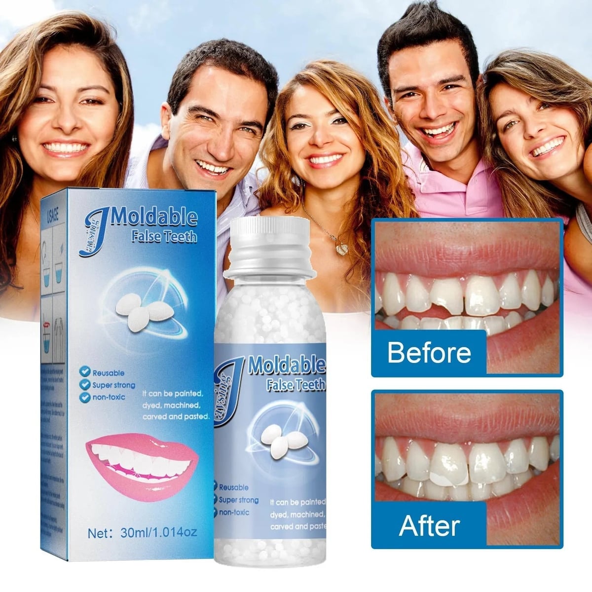 ULTIMAS UNIDADES - RESINA DENTAL MOLDEABLE 💫 ENVÍO GRATIS