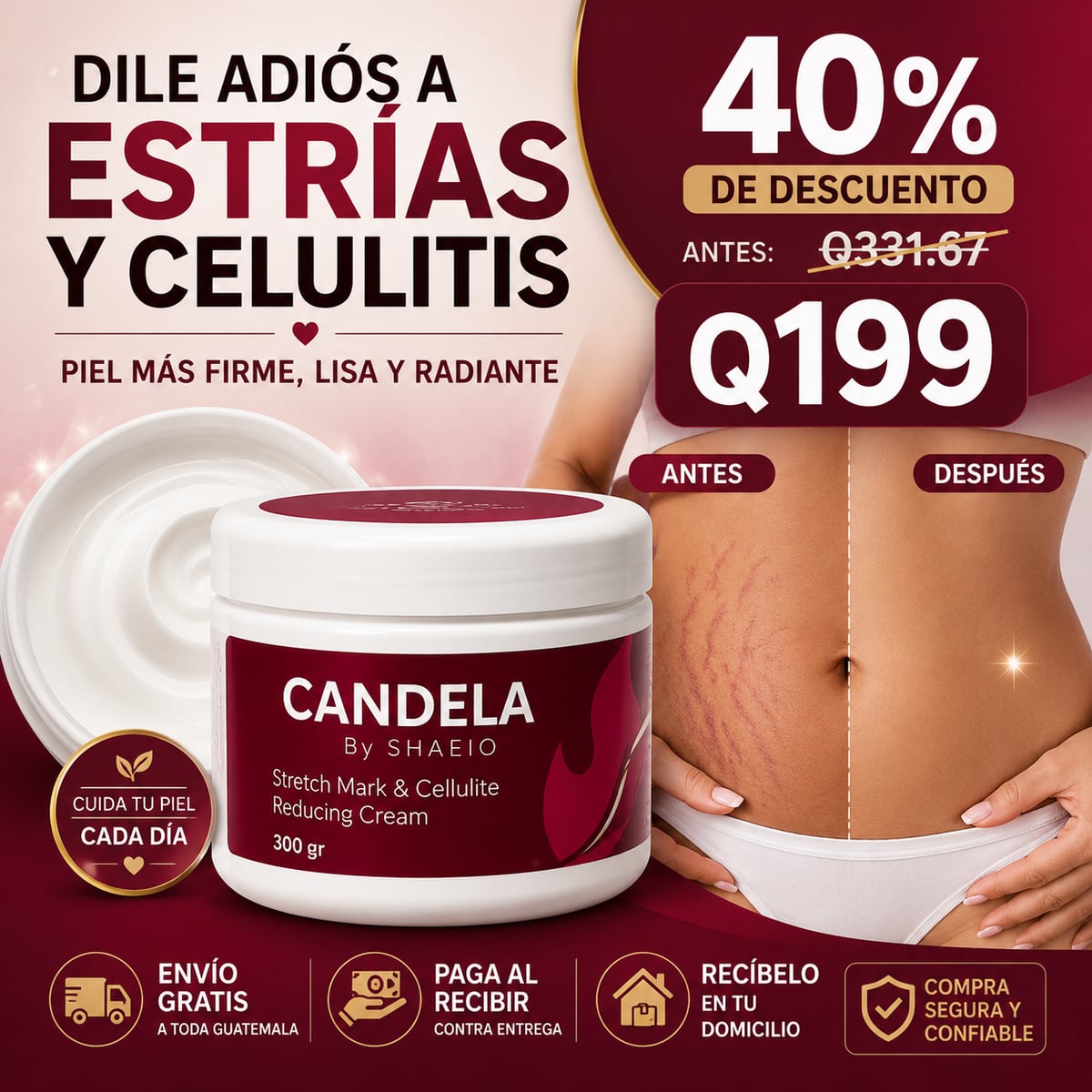 Candela by Shaeio - ¡Dile Adiós a las Estrías y Celulitis!